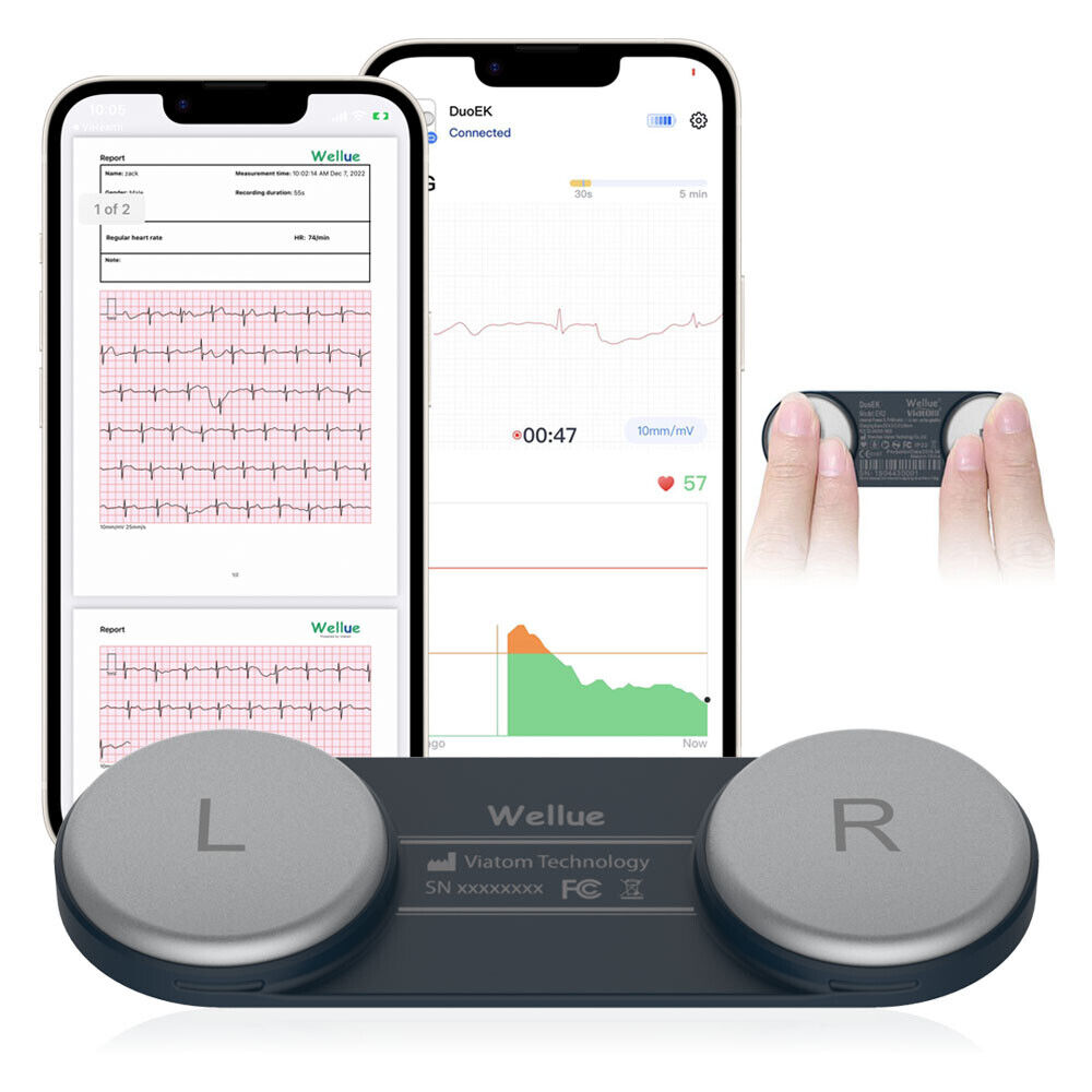 Heart Rate Monitor Portable EKG Monitor 30s - 15mins ECG Recording via free APP